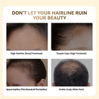 Springorigin Hairline Powder – Root Touch Up, Gray Coverage & Hairline Concealer, 48H Stain-Proof, for Women & Men