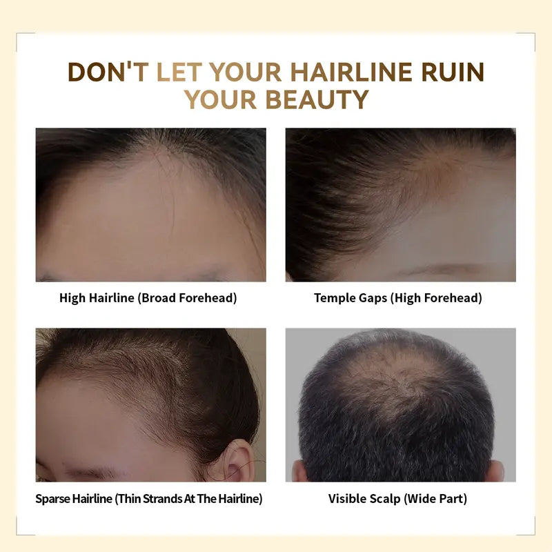 Springorigin Hairline Powder – Root Touch Up, Gray Coverage & Hairline Concealer, 48H Stain-Proof, for Women & Men